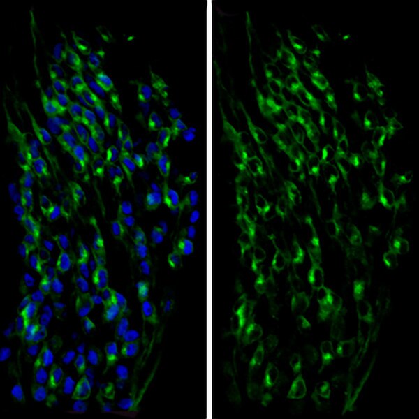 TRKC expression in E11.5 ISL1+ DRG neurons using DSHB antibody 39.4D5 anti-Islet-1 & Islet-2 homeobox (blue). PMID: 31515492, Fig 1E.